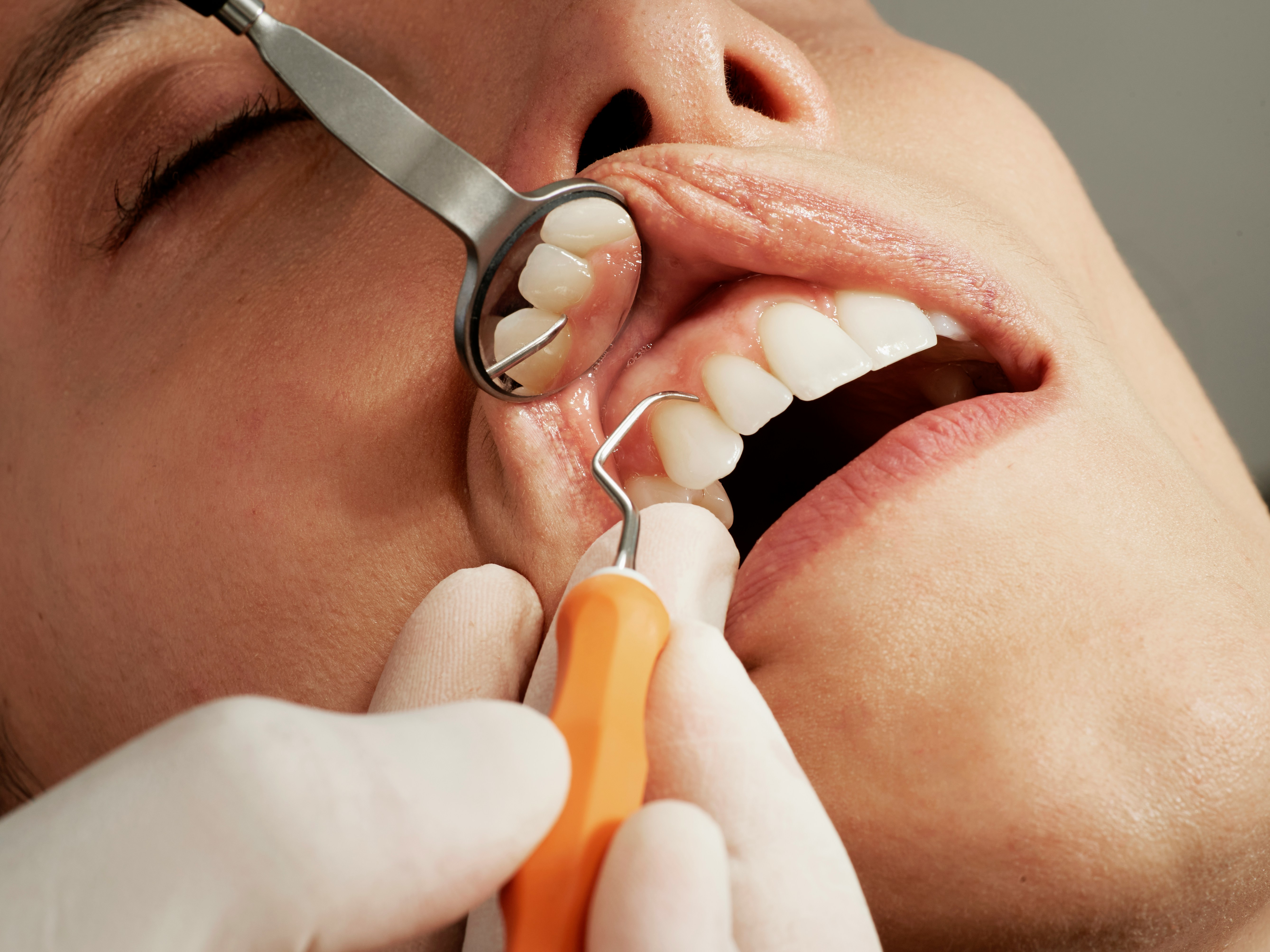 The Importance of Regular Dental Check-ups and Consultations