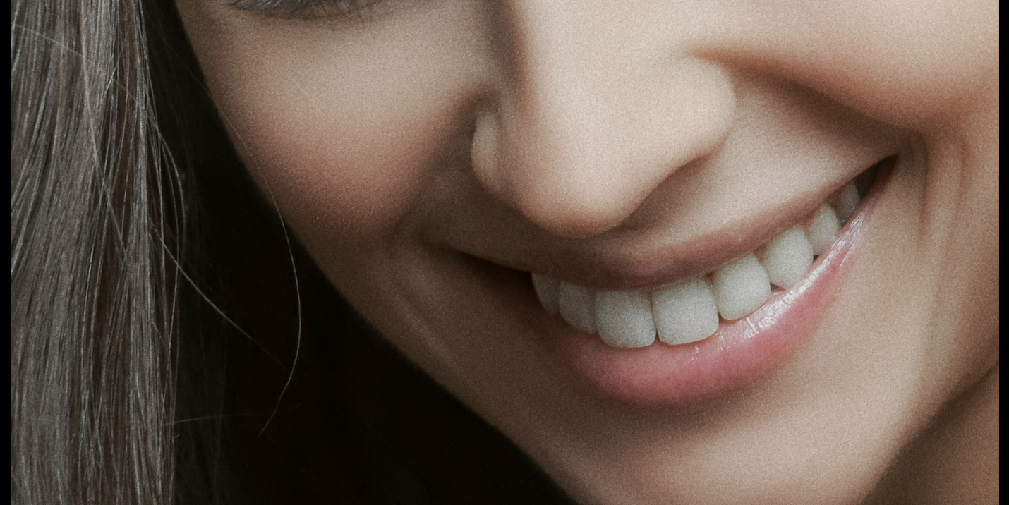 Digital Smile Design (DSD)