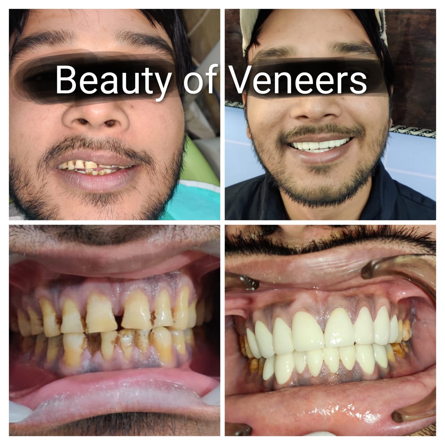 Happy patient with a new smile