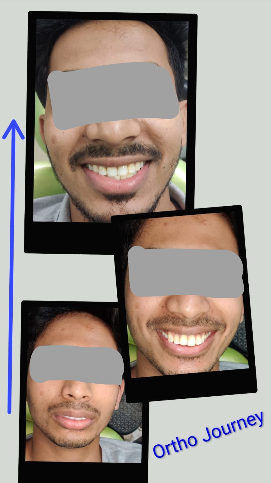Patient showing off their bright smile