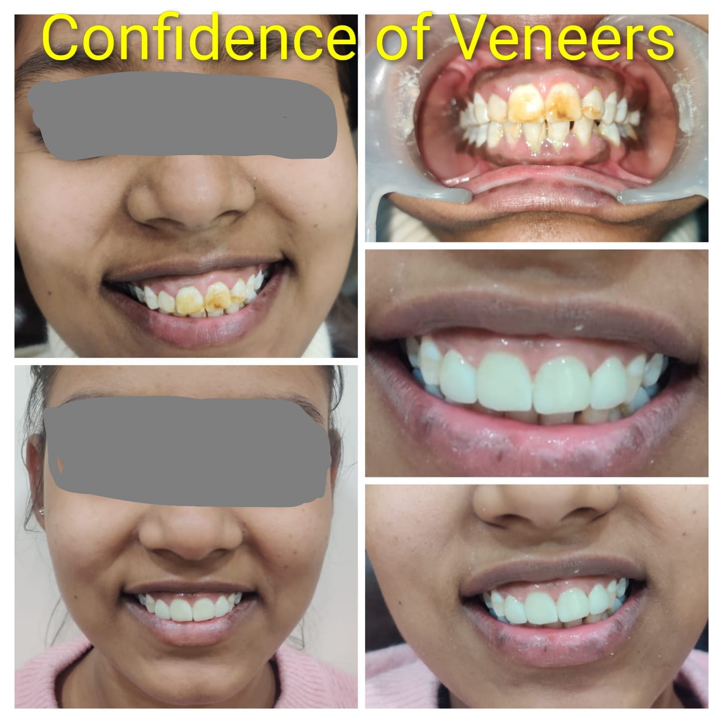 A confident smile after dental treatment